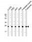 UQCRFS1 Antibody (Center)